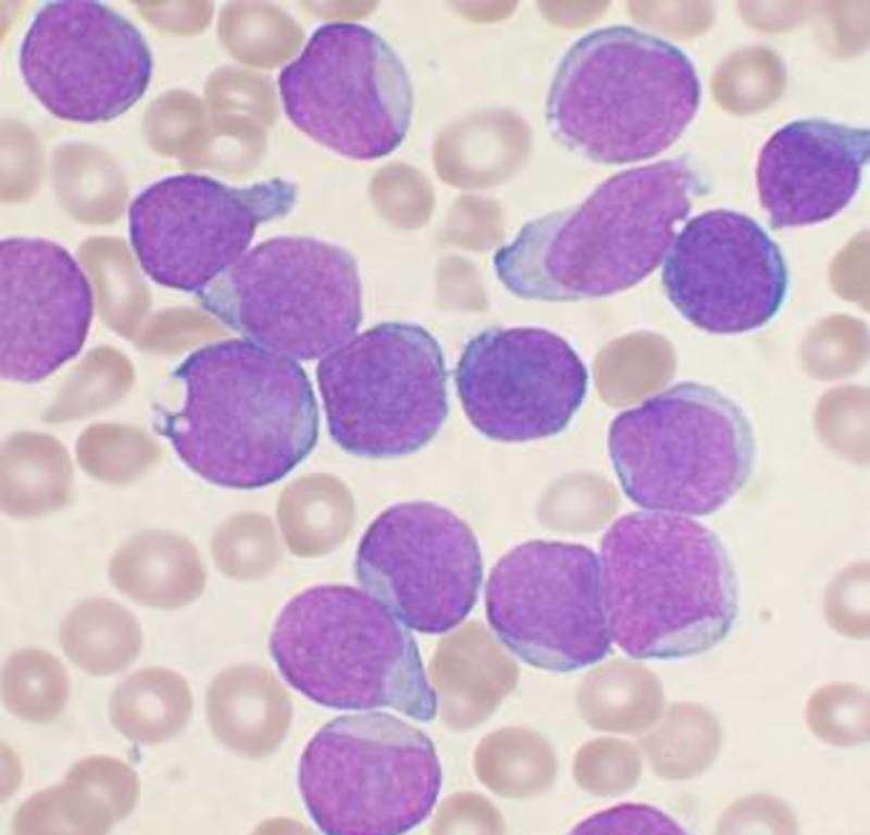 Novartis’ Kymriah receives FDA approval for B-cell precursor ALL treatment