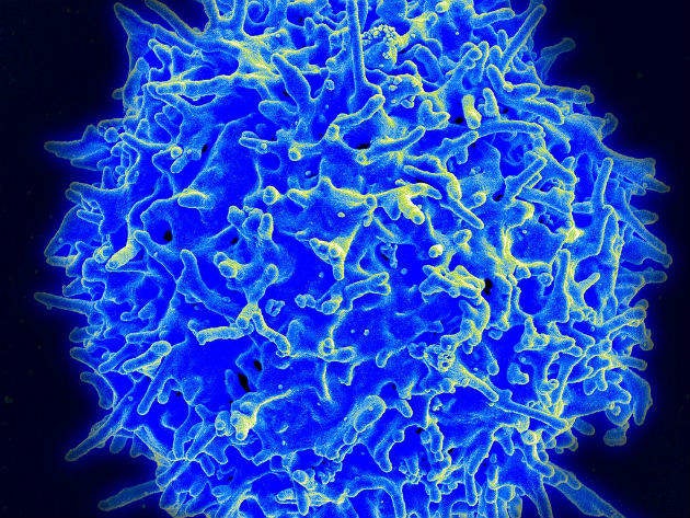Betting big on Gamma Delta T Cells