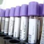 Speeding up European clinical trial regulation