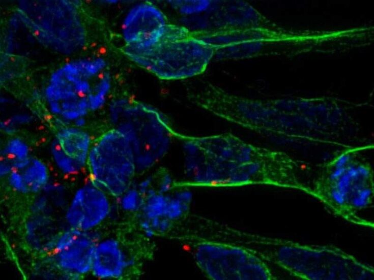 Researchers develop new stem-cell based stroke treatment