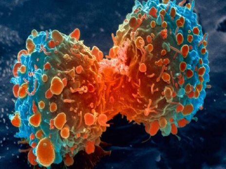 Researchers discover protein that ‘switches on’ cancer drug resistance