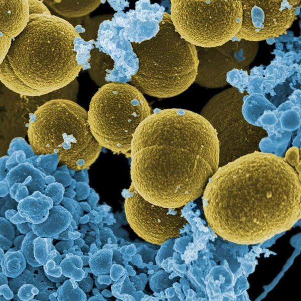 Premium Photo  Staphylococcus aureus antibiotic resistant bacteria