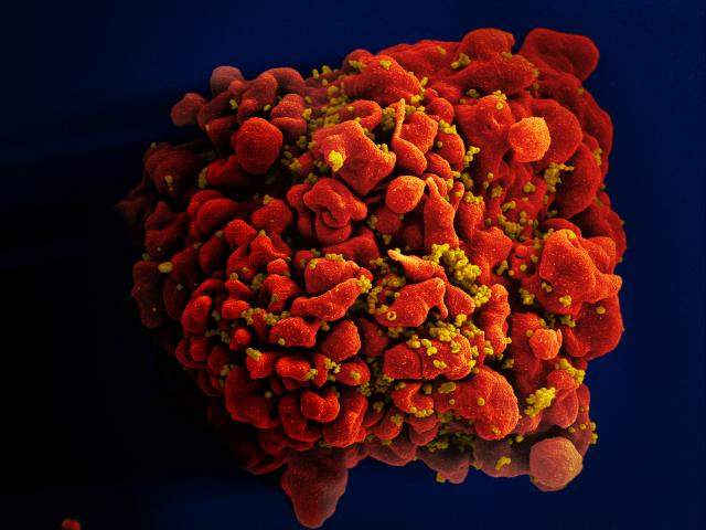 Block and lock: a functional cure for HIV?