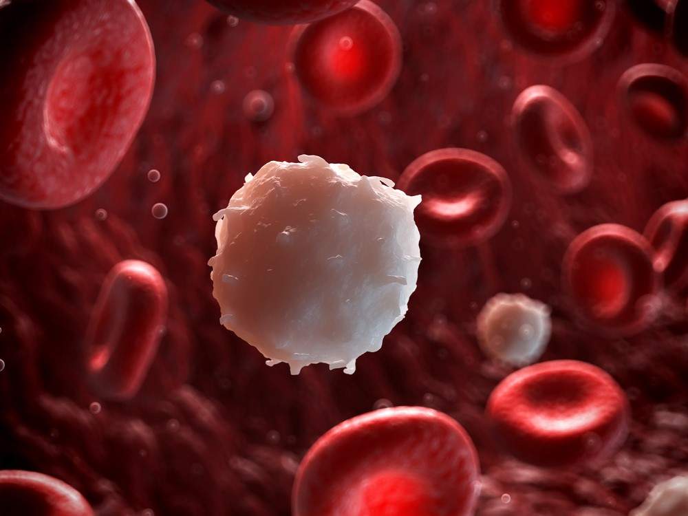 What is Blood Cancer High White Cell Count?