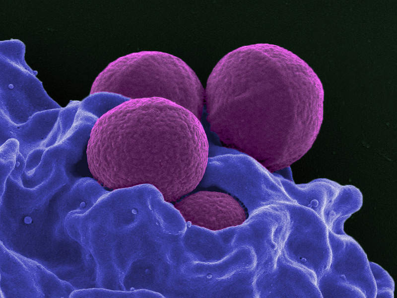 drug-resistant superbugs