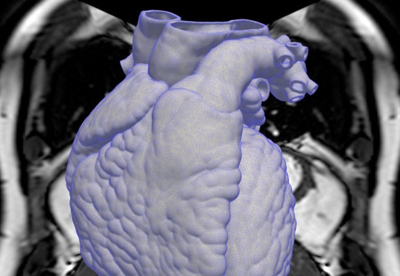 AI heart drug discovery