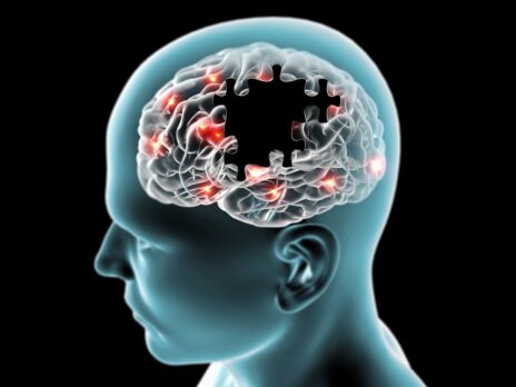 Retinal biomarker could help detect Alzheimer's earlier