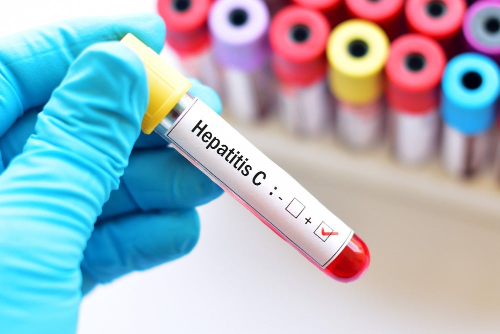 Hepatitis C infection prevalence