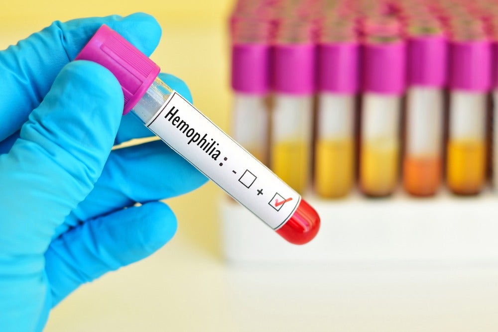 hemophilia treatment overview