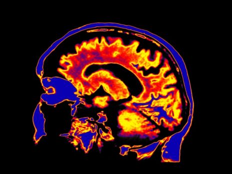 Neurology market to see an increased focus on rare diseases