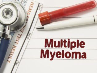 Multiple myeloma 2027