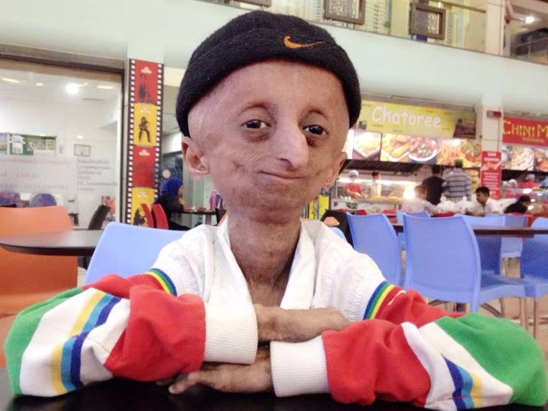 Progeria treatment advances