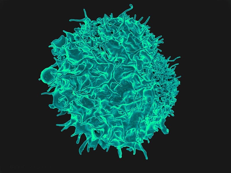 exhausted T cells