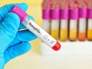Haemophilia B treatment