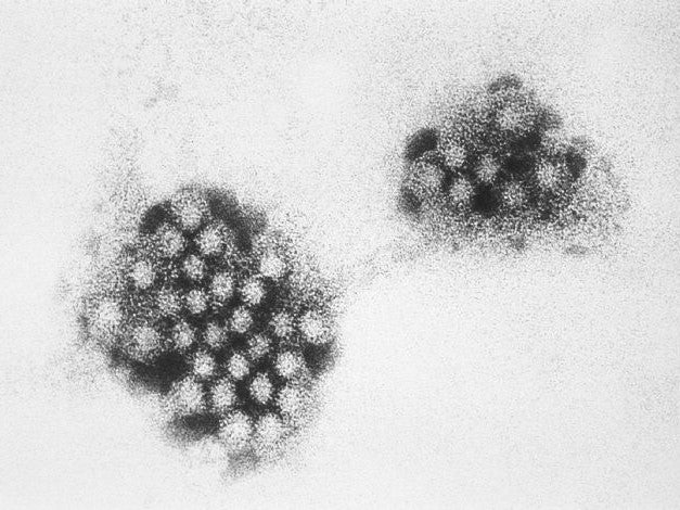 norovirus vaccine progress