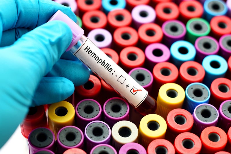 Haemophilia epidemiology forecast