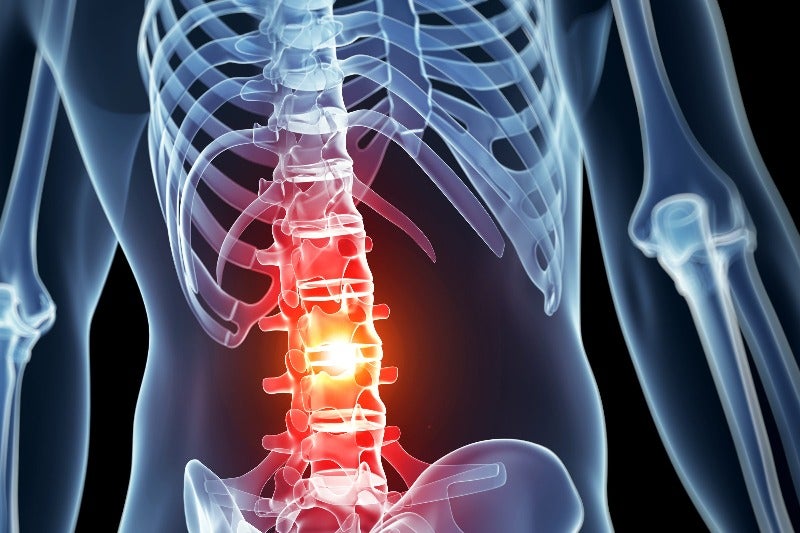 Spinal cords highlighted