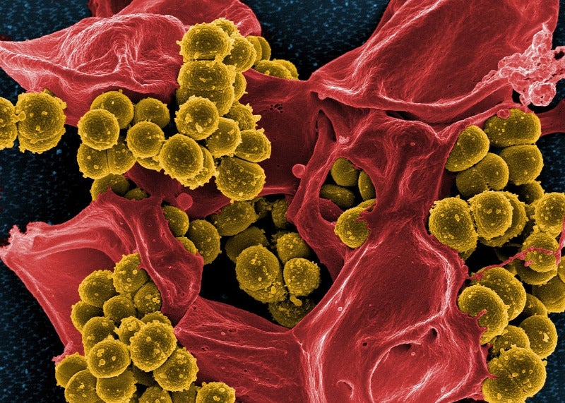 VenatoRx forms public alliance to develop new antibiotic