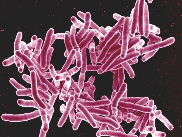 drug-resistant TB