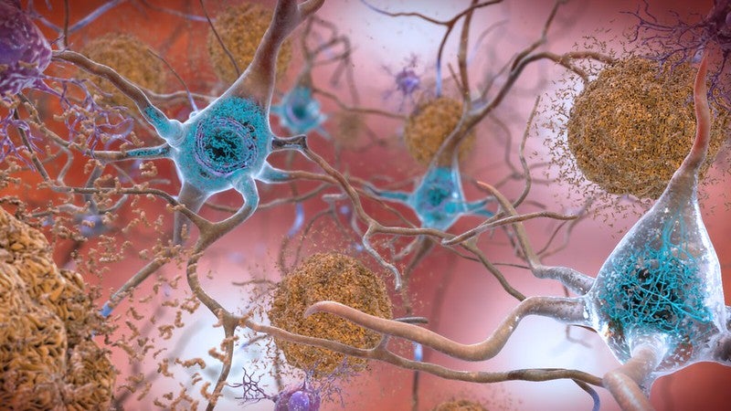 Biogen plans to seek FDA approval for Alzheimer’s drug