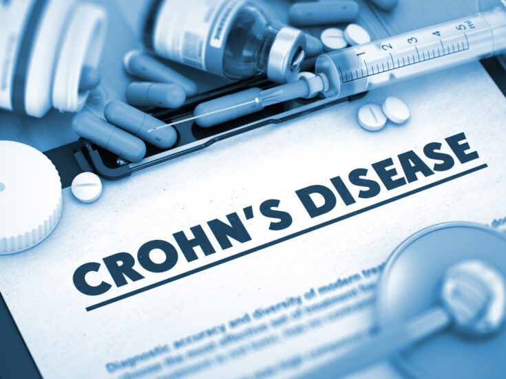 The Crohn’s disease market will continue to rise, dominated by the US, says GlobalData