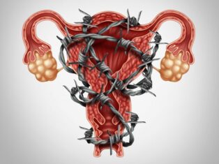 endometriosis treatments