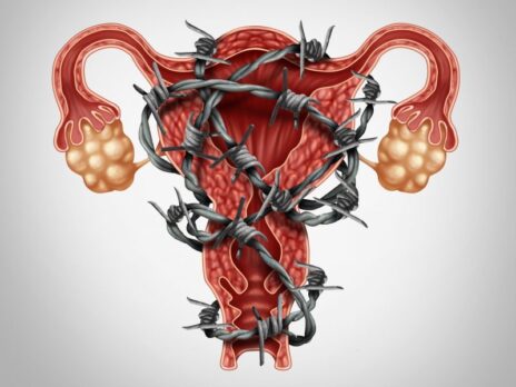 Can new therapies tackle the burden of endometriosis?