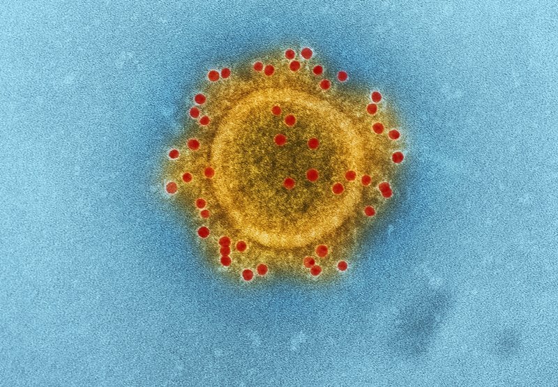 Thailand tops high risk countries from coronavirus, says study