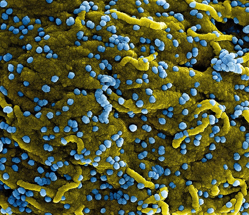 Coronavirus Vir Biotechnology and Novavax announce vaccine plans