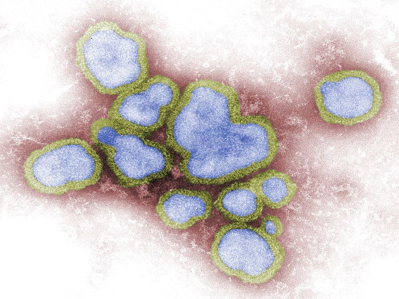 Digitally-colorized transmission electron microscopic image of influenza A virions. Credit: Sanofi Pasteur.