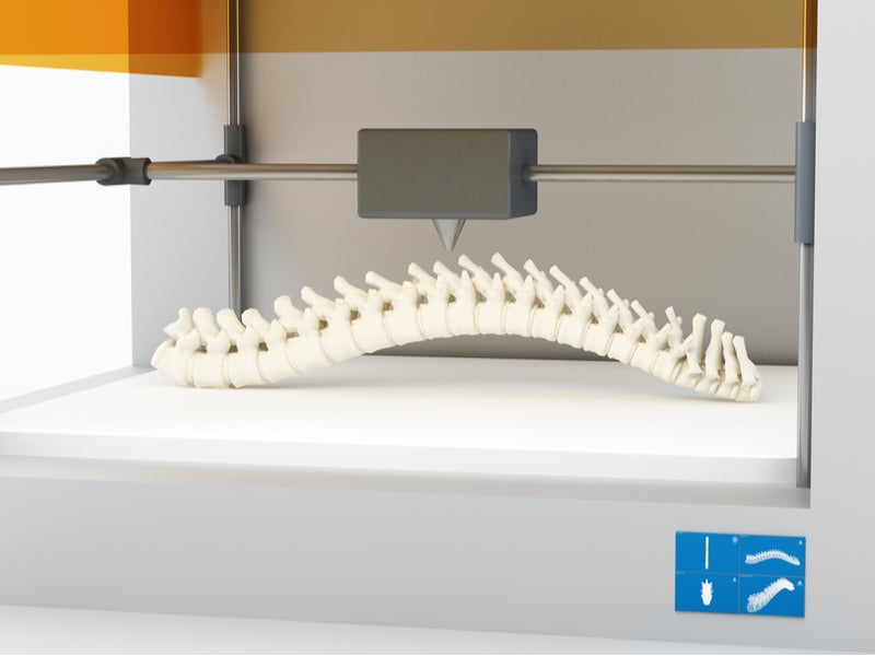 3D Printing in Healthcare: Timeline