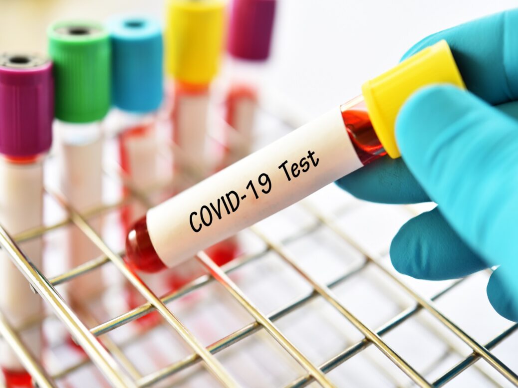Covid-19 antibody tests