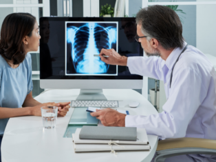 Lung cancer screening guidelines