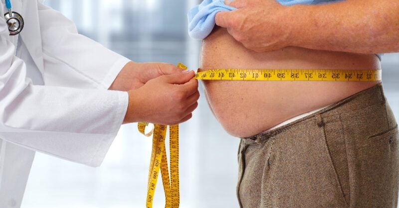 Obesity increases the risk of severe illness and death in Covid-19 patients