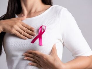 HER2+ breast cancer