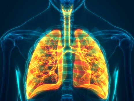 The Middle East has seen the largest growth in respiratory-related trials over the past decade