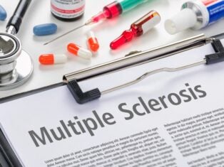 The Epstein-Barr virus could be the leading cause of multiple sclerosis