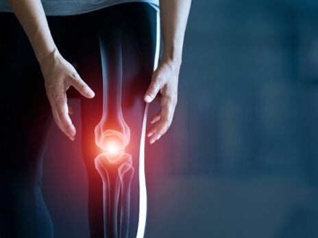 Pipeline therapies promising better disease management for osteoarthritis
