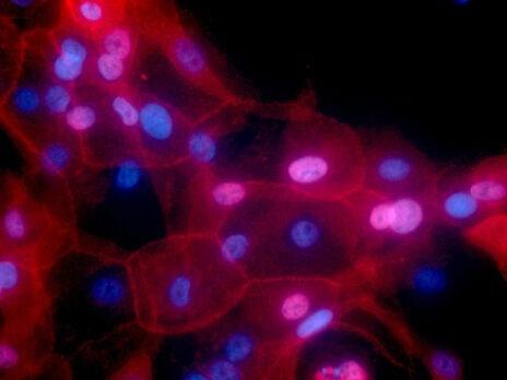 FDA grants fast track designation for SQZ’s solid tumour cell therapy