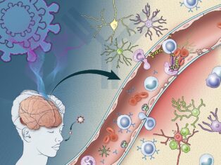 Covid-19 induced immune response may damage brain, NINDS study finds