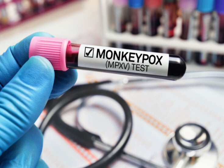 ViiV results show the importance of INIs to future HIV treatment