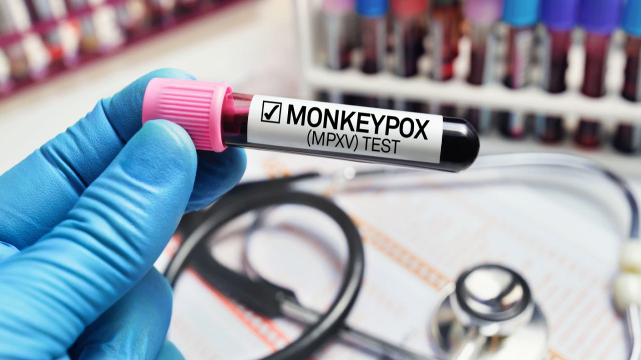 Top tweets: CDC’s concern over UK’s Monkeypox outbreak and more