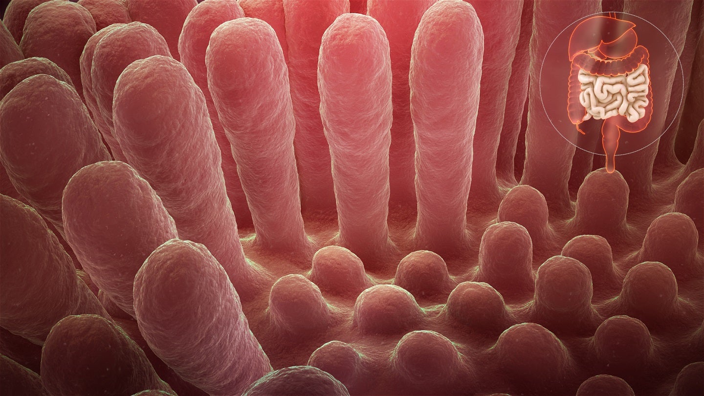 Innate Pharma and Takeda sign licence deal to develop ADCs for coeliac disease