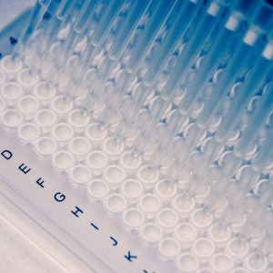 kinase assay kits