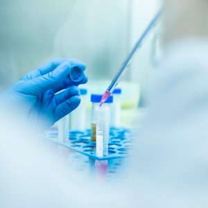 Asahi Kasei agreement