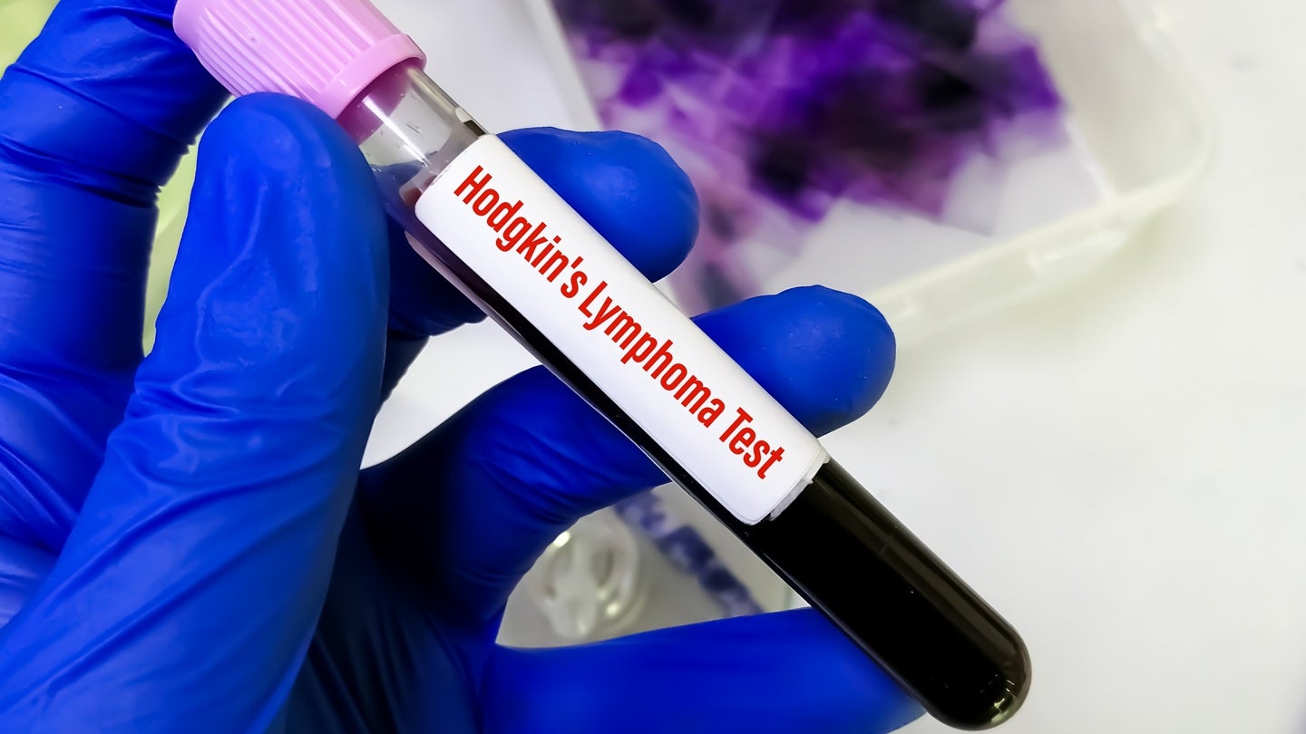 BMS secures FDA, EC approvals for Opdivo in Hodgkin Lymphoma