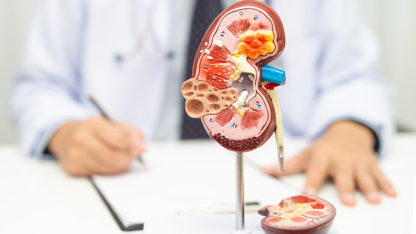 Travere Therapeutics gains FDA approval for sparsentan in FSGS