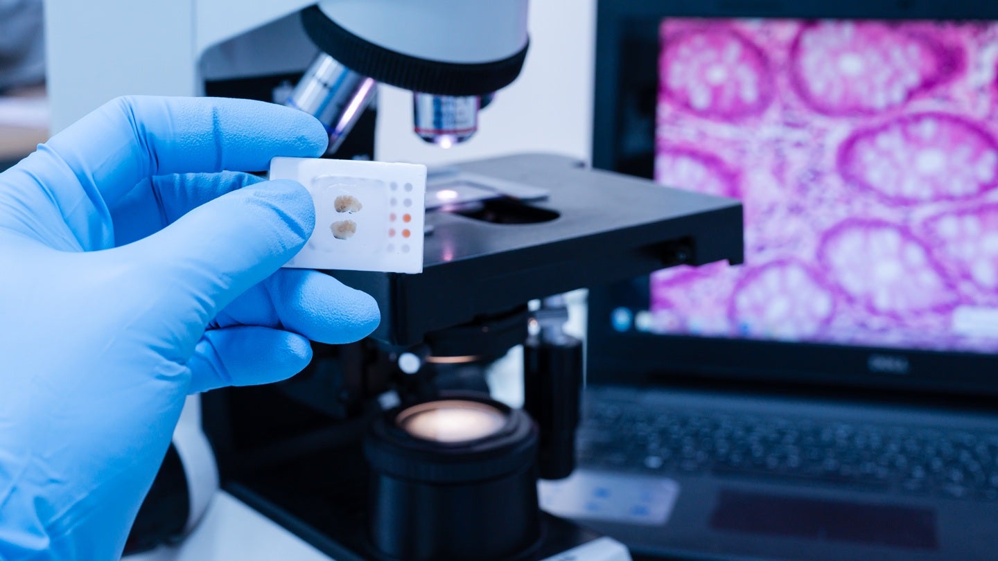 BioAegis and Prenosis partner for inflammatory disease therapies