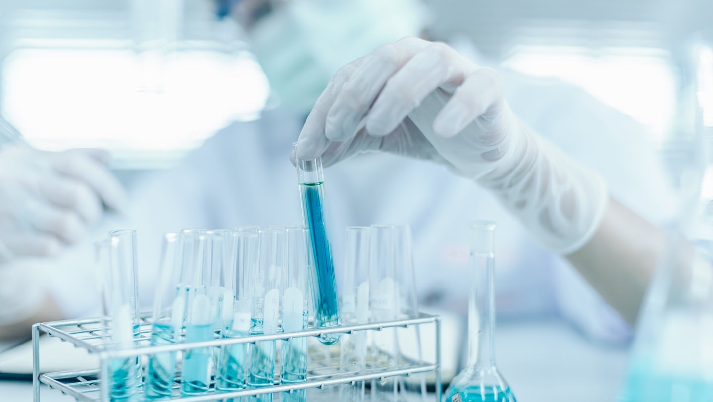University of Edinburgh develops cell therapy for liver disease