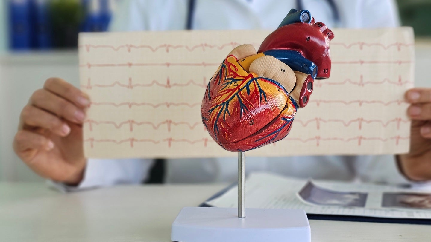 BMS secures FDA acceptance for Camzyos sNDA